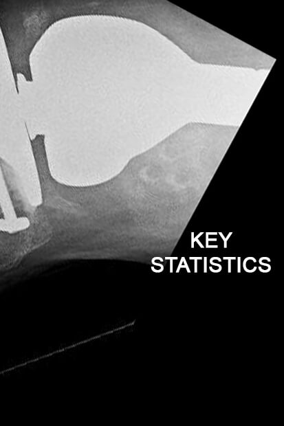 key statistics